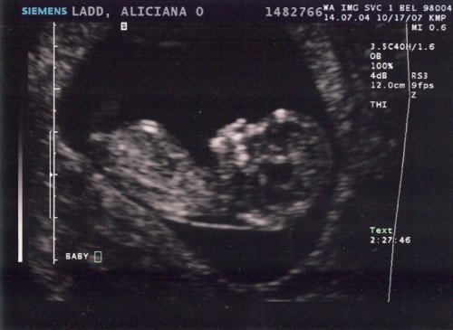 baby ultrasound 1