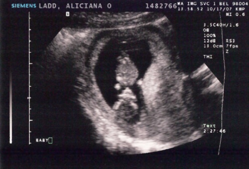 baby ultrasound 2